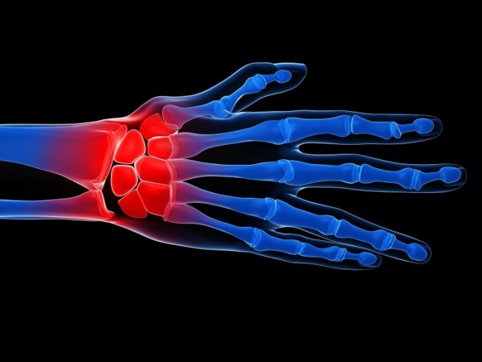 inflammation-hyman1-700x525.