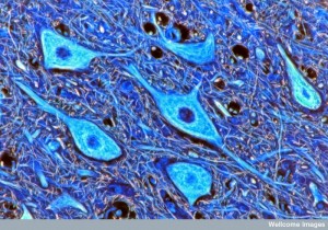 WC-brain-cells--300x210.